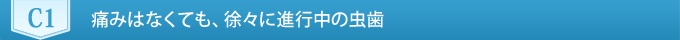 C1　痛みはなくても、徐々に進行中の虫歯