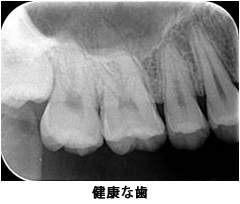 健康な歯