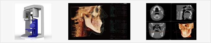 歯科用CTを使用した精密な診断