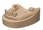 歯列模型製作