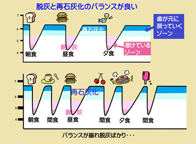 歯は脱会と再石灰化の競争です